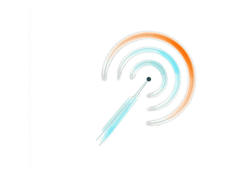 Channels illustration